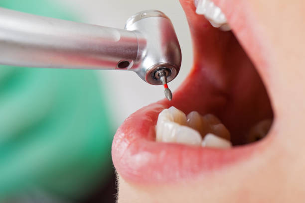 Best Cracked Tooth Emergency Dentist  in Adamsville, AL